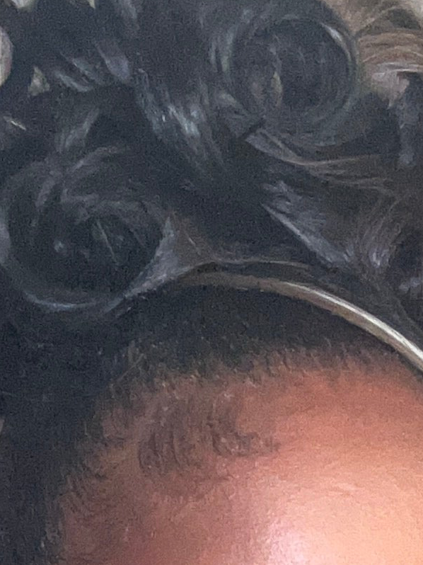 HAIR